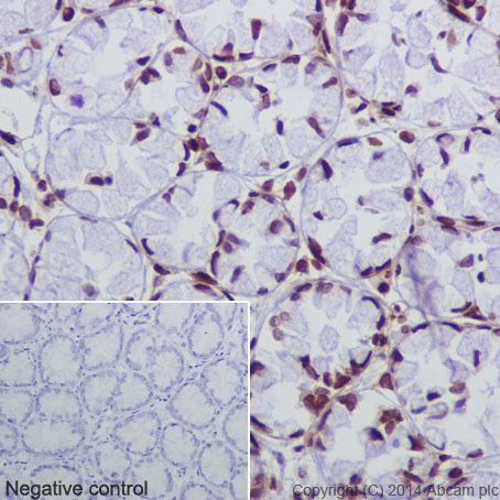 Immunohistochemical analysis of paraffin-embedded rat colon tissue labeling Histone H2B (crotonyl K12) with ab177420 at 1/1000 dilution followed by Goat Anti-Rabbit IgG H&L (HRP) (ab97051) secondary antibody at 1/500 dilution. Nucleus staining on glandular epithelium of rat colon tissue is observed. Counter stained with Hematoxylin.Negative control: Using PBS instead of primary antibody, secondary antibody is Goat Anti-Rabbit IgG H&L (HRP) (ab97051) secondary antibody at 1/500 dilution.