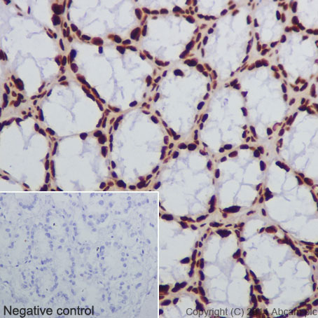 Immunohistochemical analysis of paraffin-embedded mouse colon tissue labeling Histone H2B (crotonyl K12) with ab177420 at 1/1000 dilution followed by Goat Anti-Rabbit IgG H&L (HRP) (ab97051) secondary antibody at 1/500 dilution. Nucleus staining on glandular epithelium of mouse colon tissue is observed. Counter stained with Hematoxylin.Negative control: Using PBS instead of primary antibody, secondary antibody is Goat Anti-Rabbit IgG H&L (HRP) (ab97051) secondary antibody at 1/500 dilution.