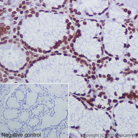 Immunohistochemical analysis of paraffin-embedded Human colon tissue labeling Histone H2B (crotonyl K12) with ab177420 at 1/1000 dilution followed by Goat Anti-Rabbit IgG H&L (HRP) (ab97051) secondary antibody at 1/500 dilution. Nucleus staining on glandular epithelium of Human colon tissue is observed. Counter stained with Hematoxylin.Negative control: Using PBS instead of primary antibody, secondary antibody is Goat Anti-Rabbit IgG H&L (HRP) (ab97051) secondary antibody at 1/500 dilution.