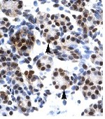Immunohistochemical detection of HES7 using 4 ug/ml ab26062 in paraffin embedded human pancreas tissue section. Arrows indicate positively labelled epithelial cells of the pancreatic acinus.