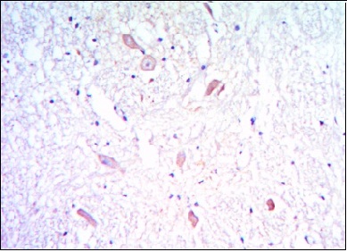 ab101439, at a 1/200 dilution, staining KLHL13 in paraffin-embedded Human brain tissue using DAB staining.