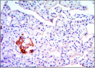 ab101439, at a 1/200 dilution, staining KLHL13 in paraffin-embedded Human pancreas tissue using DAB staining.