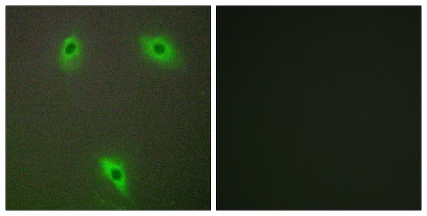 Immunofluorescent analysis of A549 cells labeling KLHL3 with ab196776 at 1/100 dilution. The image on the right is treated with synthesized peptide.
