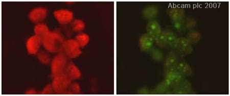 ab38637 at 1/50 staining human HEK293 cells by ICC/IF. The cells were formaldehyde fixed, blocked with BSA and incubated with the antibody for 1 hour. A goat anti-rabbit IgG was used as the secondary.See Abreview