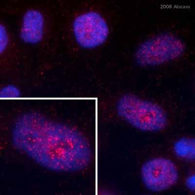 ab38637 staining cultured human HeLa cells by ICC/IF. Cells were PFA fixed and permeabilized in 0.5% Triton X100 prior to blocking in 5% BSA for 1 hour at 20°C. The primary antibody was diluted 1/200 and incubated with the sample for 1 hour at 20°C. A Cy3® conjugated donkey anti-rabbit antibody diluted 1/400 was used as the secondary.See Abreview