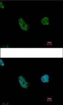 Immunofluorescence analysis of HeLa cells fixed in 4% paraformaldehyde for 5 minutes, labeling KMT1C / G9a using ab183889 at a 1/500 dilution (green). Blue: Hoechst 33342 staining.