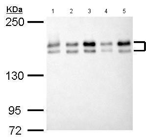 All lanes : Anti-KMT1C / G9a antibody (ab183889) at 1/1000 dilutionLane 1 : 293T whole cell lysate/extractLane 2 : A431 whole cell lysate/extractLane 3 : HeLa whole cell lysate/extractLane 4 : HepG2 whole cell lysate/extractLane 5 : A375 whole cell lysate/extractLysates/proteins at 30 µg per lane.