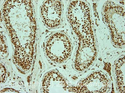 IHC image of ab61329 staining in normal human testis formalin fixed paraffin embedded tissue section, performed on a Leica BondTM system using the standard protocol F. The section was pre-treated using heat mediated antigen retrieval with sodium citrate buffer (pH6, epitope retrieval solution 1) for 20 mins. The section was then incubated with ab61329, 1µg/ml, for 15 mins at room temperature and detected using an HRP conjugated compact polymer system. DAB was used as the chromogen. The section was then counterstained with haematoxylin and mounted with DPX.For other IHC staining systems (automated and non-automated) customers should optimize variable parameters such as antigen retrieval conditions, primary antibody concentration and antibody incubation times.