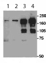 Whole cell lysate (2 mg) from 293T cells that were mock transfected (1 and 2) or transfected with a SETDB1 expression construct (3 and 4). Rabbit anti-SETDB1 antibodies; ab12317 (2 and 4) and a competitor's antiserum (1 and 3) were used at 1 mcg/mg lysate for IP. ab12317 was used at 0.2 mcg/ml for Western Blot. Detection: Chemiluminescence with exposure times of 1 to 5 minutes.