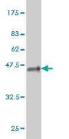 Western blot against tagged recombinant protein immunogen using ab56770 MLL4 antibody at 1ug/ml. 