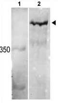 All lanes : Anti-KMT2C / MLL3 antibody (ab71200) at 1/1000 dilutionLane 1 : Molecular weight markersLane 2 : HEK 293 cell line lysateLysates/proteins at 12.5 µg per lane.SecondaryHRP goat anti-rabbit (H+L) at 1/5000 dilution