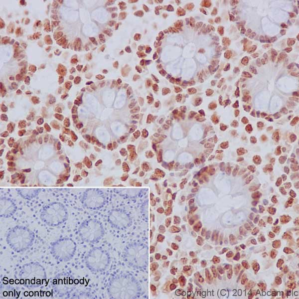 Immunohistochemical analysis of paraffin-embedded Human colon tissue labeling Histone H2B (mono methyl K5) with ab188340 at 1/2000 dilution, followed by Goat Anti-Rabbit IgG H&L (HRP) (ab97051) secondary antibody at 1/500 dilution. Nucleus staining on Human colon tissue is observed. Counter stained with Hematoxylin.Secondary antibody only control: Used PBS instead of primary antibody, secondary antibody is Goat Anti-Rabbit IgG H&L (HRP) (ab97051) at 1/500 dilution.