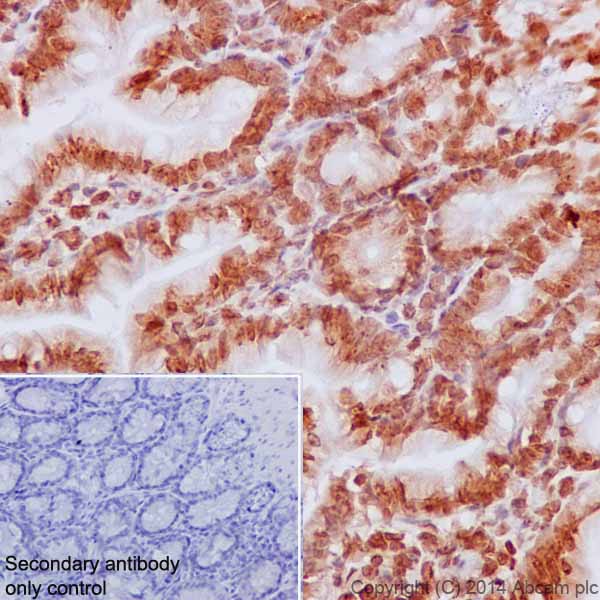 Immunohistochemical analysis of paraffin-embedded Mouse colon tissue labeling Histone H2B (mono methyl K5) with ab188340 at 1/2000 dilution, followed by Goat Anti-Rabbit IgG H&L (HRP) (ab97051) secondary antibody at 1/500 dilution. Nucleus staining on mouse colon tissue is observed. Counter stained with Hematoxylin.Secondary antibody only control: Used PBS instead of primary antibody, secondary antibody is Goat Anti-Rabbit IgG H&L (HRP) (ab97051) at 1/500 dilution.