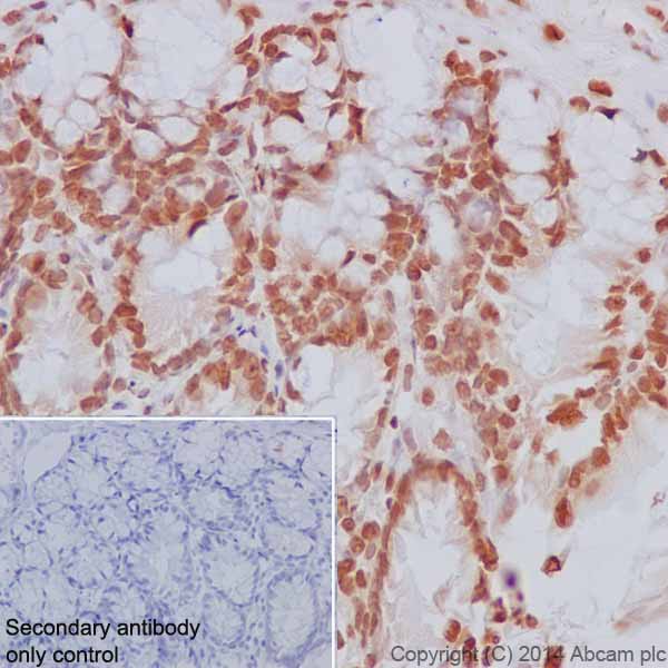 Immunohistochemical analysis of paraffin-embedded Rat colon tissue labeling Histone H2B (mono methyl K5) with ab188340 at 1/2000 dilution, followed by Goat Anti-Rabbit IgG H&L (HRP) (ab97051) secondary antibody at 1/500 dilution. Nucleus staining on rat colon tissue is observed. Counter stained with Hematoxylin.Secondary antibody only control: Used PBS instead of primary antibody, secondary antibody is Goat Anti-Rabbit IgG H&L (HRP) (ab97051) at 1/500 dilution.