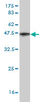 Western blot against tagged recombinant protein immunogen using ab56877 KPI2 antibody at 1ug/ml.