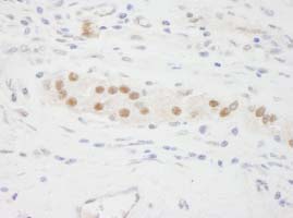 Detection of Human KPNA3 by Immunohistochemistry.Sample: FFPE section of Human testis.Antibody: ab84706 used at a dilution of 1/500.Detection: DAB staining.
