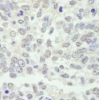 Detection of Mouse KPNA3 by Immunohistochemistry.Sample: FFPE section of Mouse teratoma.Antibody: ab84706 used at a dilution of 1/250.Detection: DAB staining.