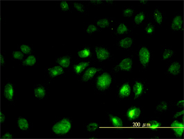 KRT23 antibody (ab57232) used in immunofluorescence at 10ug/ml on HeLa cells.