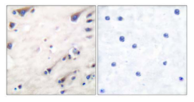 Immunohistochemical analysis of paraffin-embedded human brain tissue using ab52196 at a 1/50 dilution.Left image un-treated.Right image treated with peptide.