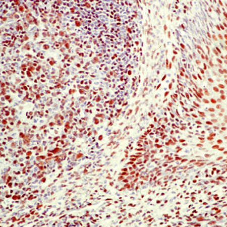 Human tonsil stained with Ku70 + Ku80 antibody [SPM274] (ab54269)
