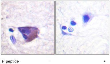 ab61107, at a 1/50-1/100 dilution, staining human KCNB1 in brain tissue with(+) or without(-) immunising phospopeptide, using Immunohistochemistry, Paraffin embedded tissue