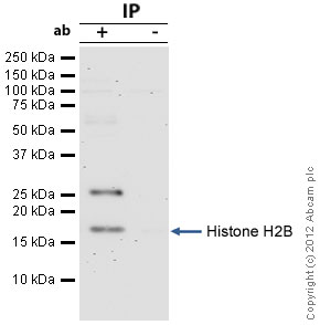 Histone H2B was immunoprecipitated using 0.5mg Hela whole cell extract, 5µg of Mouse monoclonal to Histone H2B and 50µl of protein G magnetic beads (+). No antibody was added to the control (-). The antibody was incubated under agitation with Protein G beads for 10min, Hela whole cell extract lysate diluted in RIPA buffer was added to each sample and incubated for a further 10min under agitation.Proteins were eluted by addition of 40µl SDS loading buffer and incubated for 10min at 70oC; 10µl of each sample was separated on a SDS PAGE gel, transferred to a nitrocellulose membrane, blocked with 5% BSA and probed with ab52484.Secondary: Protein G-HRP at 1/500 dilution.Band: 17kDa; Histone H2B; non specific bands - 26kDa: We are unsure as to the identity of this extra band.