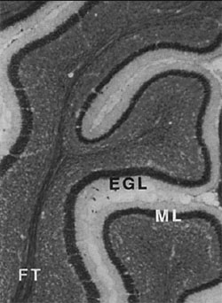 ab24345 (1/500) immunostaining L1CAM  in 4% PFA-fixed rat cerebellum tissue. ML = molecular layer and FT = fiber tract of the cerebellum.
