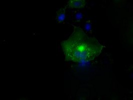 ab114019 at 1/100 dilution staining L1CAM in COS7 cells transiently transfected by pCMV6-ENTRY L1CAM and analyzed by immunofluorescence.