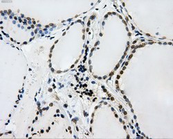 ab114019 at 1/50 dilution staining L1CAM in Human thyroid tissue by immunohistochemistry (FFPE).