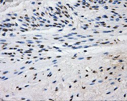 ab114019 at 1/50 dilution staining L1CAM in Human endometrium tissue by immunohistochemistry (FFPE).