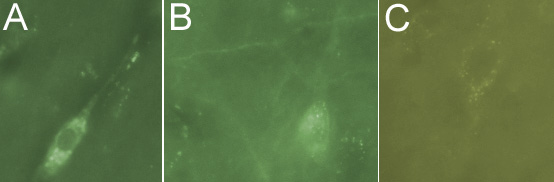 ab3200 at a dilution of 1/1000, staining L1CAM (green; Alexa 488 secondary at 1/2000) on 30µm coronal rat brain tissue sections in free floating IHC (see protocol link for detailed description). Images showing neuron body, cytoplasm and axon labeling: [A] neuron; 40x objective [B] neuron and axons; 40x objective and [C] punctate cytoplasmic labeling. Images coloured in Photoshop.NB: No labeling observed following omission of primary antibody.Sections were viewed using an Axioplan 2 Imaging microscope (Imaging Associates) fitted with 10x, 20x and 40x Plan-Neofluorobjectives (Zeiss, Germany) and images were taken using a AxioCam Hrm digital camera (Zeiss, Germany) and AxioVision software (Imaging Associates).