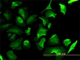 Lactate Dehydrogenase antibody (ab55433) used in immunofluorescence at 10ug/ml on HeLa cells.