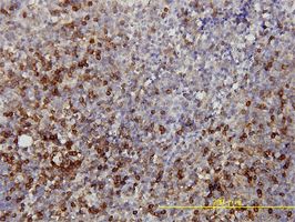 Lactate Dehydrogenase antibody (ab55433) used in immunohistochemistry at 5ug/ml on formalin fixed and paraffin embedded human tonsil tissue.