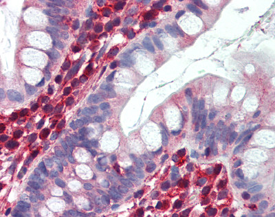 ab75167 at 5 µg/ml staining lactate dehydrogenase B in Human placenta by Immunohistochemistry (Formalin/PFA-fixed paraffin-embedded sections).