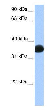 Anti-Lactate Dehydrogenase B antibody (ab75167) at 1 µg/ml + fetal muscle lysate at 10 µgSecondaryHRP conjugated anti-Rabbit IgG at 1/50000 dilution