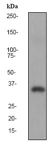 Anti-Lactate Dehydrogenase C antibody [EP1567Y] (ab75999) at 1/5000 dilution + human testis lysate at 10 µgSecondaryHRP labelled goat anti rabbit at 1/2000 dilution