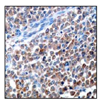Immunohistochemical staining of paraffin-embedded human testis carcinoma using ab52747 at a 1/50 dilution.