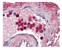 ab77548 (2µg/ml) staining of paraffin embedded Human Blood Vessel shows strong staining of cytoplasm of neutrophils. Steamed antigen retrieval with citrate buffer pH 6, AP-staining.