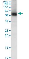 Anti-Lamin B Receptor antibody (ab169306) at 1 µg/ml + Jurkat cell lysate at 50 µgdeveloped using the ECL technique