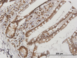 Immunohistochemical analysis of formalin-fixed, paraffin-embedded Human small intestine tissue labeling Lamin B Receptor with ab169306 at 3µg/ml.