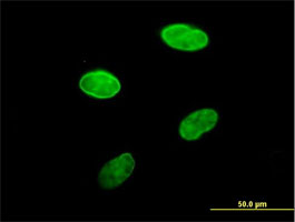 Immunofluorescent analysis of HeLa cells labeling Lamin B Receptor with ab169306 at 10µg/ml.