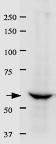 Identification of Lamin B Receptor in crude extract of HeLa cells by immuno-precipitation using ab122919, followed by Western blotting.