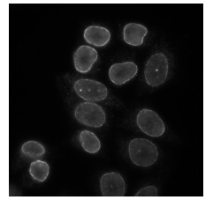 Indirect immuno-fluorescence staining of HeLa cells using ab122919.