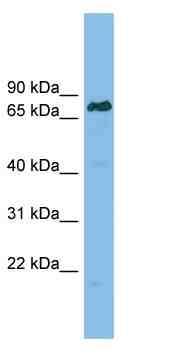 Anti-Lamin B Receptor antibody (ab102036) at 1 µg/ml + RPMI-8226 cell lysate at 10 µg
