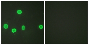 Immunocytochemical analysis of Hela cells labeling Histone H3 (acetyl K18) with ab189884 at 1/100 dilution. RIght hand image shows treatment with sythesized peptide.