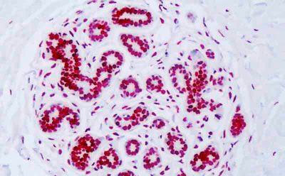 Immunohistochemical analysis of formalin fixed, parrafin embedded Human breast epithelium tissue labeling Histone H3 (acetyl K18) with ab189884 at 5 µg/ml.