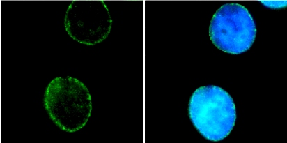 HeLa cells were fixed in 100% methanol for 6 minutes at -20°C then stained with ab8983 (1/400). This image shows that ab8983 clearly stains the nuclear envelope (green). The DNA is stained with DAPI (blue).