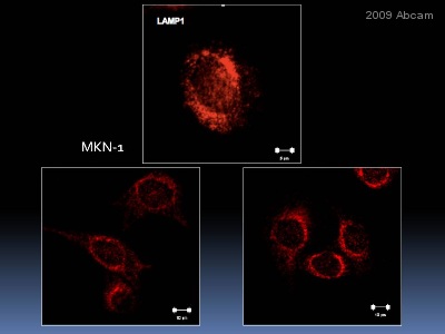 ab25630 at 1/500 dilution staining LAMP1 in human gastric cancer cells by immunocytochemistry/ immunofluorescence. Sections were methanol fixed, permeabilized in 0.5% Triton X-100 prior to blocking in 10% NGS/1% BSA for 1 hour at 25°C and then incubated with ab25630 for 2 hours at 25°C. Alexa fluor® 594 mouse polyclonal to mouse Ig, diluted 1/600, was used as the secondary antibody.See Abreview