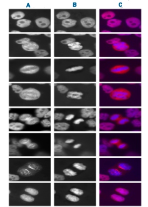 ab5162 at a dilution of 1/250 staining LAP 2 alpha in HeLa cells by immunofluorescence.A = ab5162, 1/250B = DNAC = A and B merged