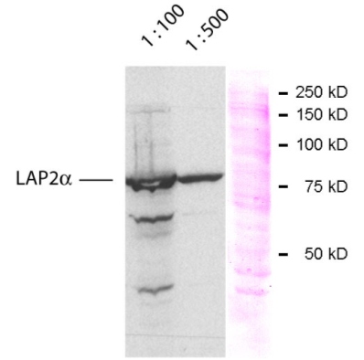ab5162 at dilutions of 1/100 and 1/500 staining approximately 83 kDa LAP 2 alpha in HeLa cell extracts by Western blot (ECL). 